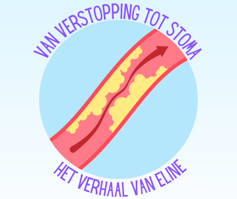 Eline heeft EDS (Ehlers-Danlos) en kreeg een dubbelloops ileostoma