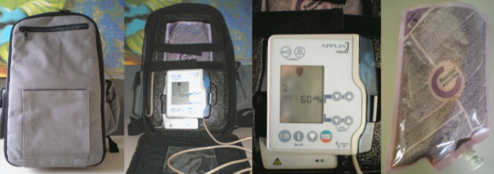 Een rugzak van buiten en van binnen, de voedingspomp en sondevoeding.